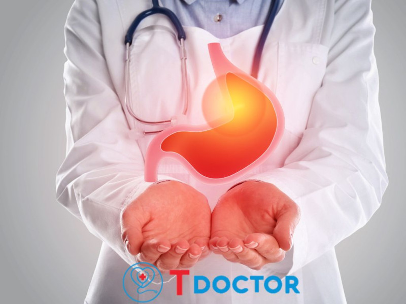 Tdoctor - Điều trị ung thư dạ dày: Các phương pháp hiệu quả và những lời khuyên quan trọng